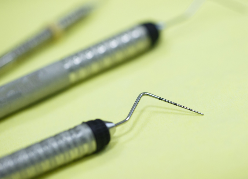 歯周ポケット検査|しろきデンタル