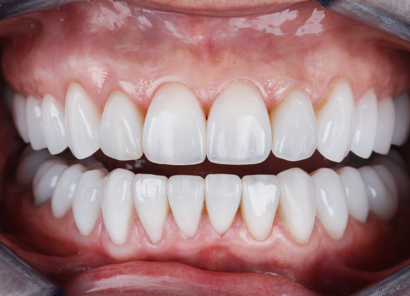 長期的な安定と健康|しろきデンタル