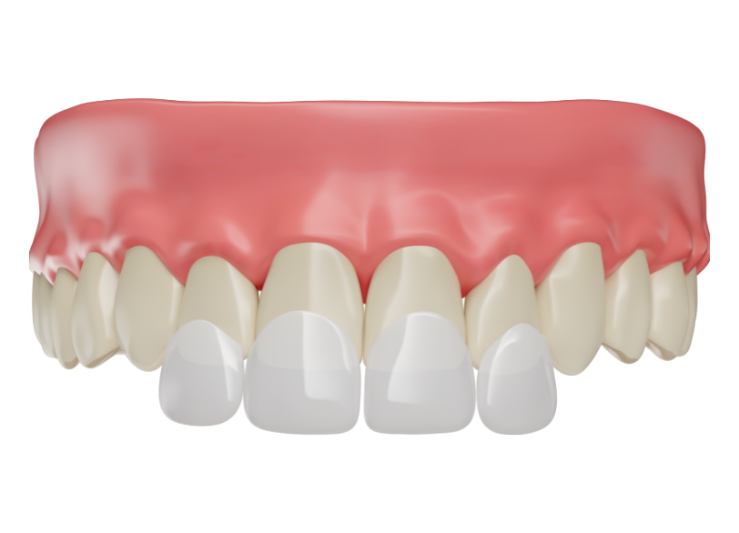 機能と審美の調和|しろきデンタル