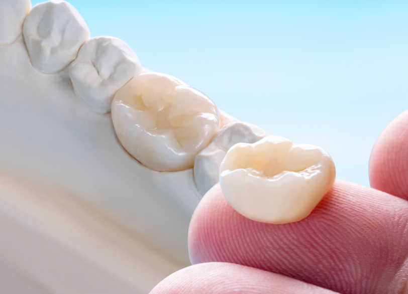 ハイブリッドレジン|しろきデンタル