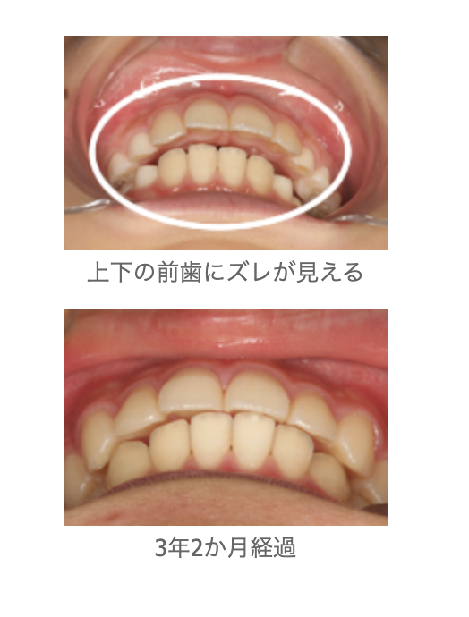 症例1|しろきデンタル