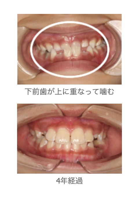 症例2|しろきデンタル