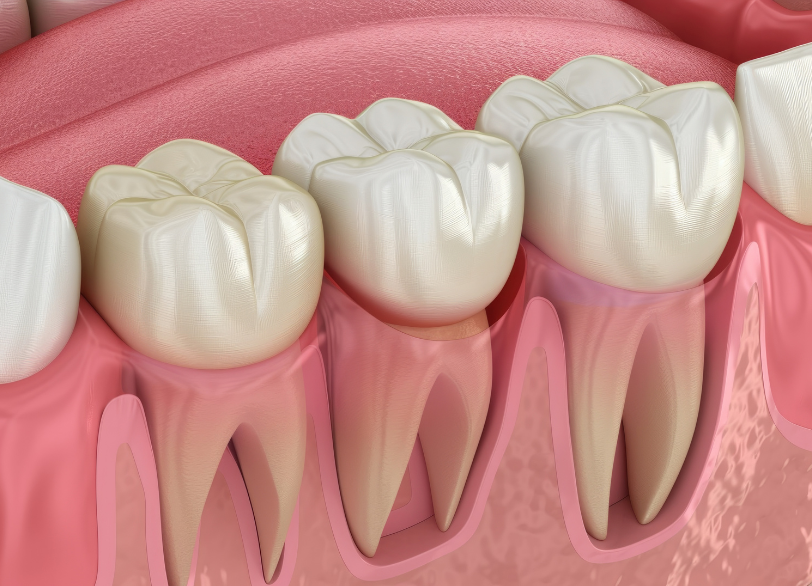 歯への影響|しろきデンタル