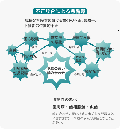 不正咬合による悪循環|しろきデンタル
