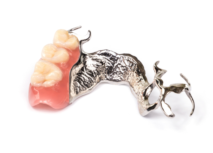 金属床義歯|しろきデンタル