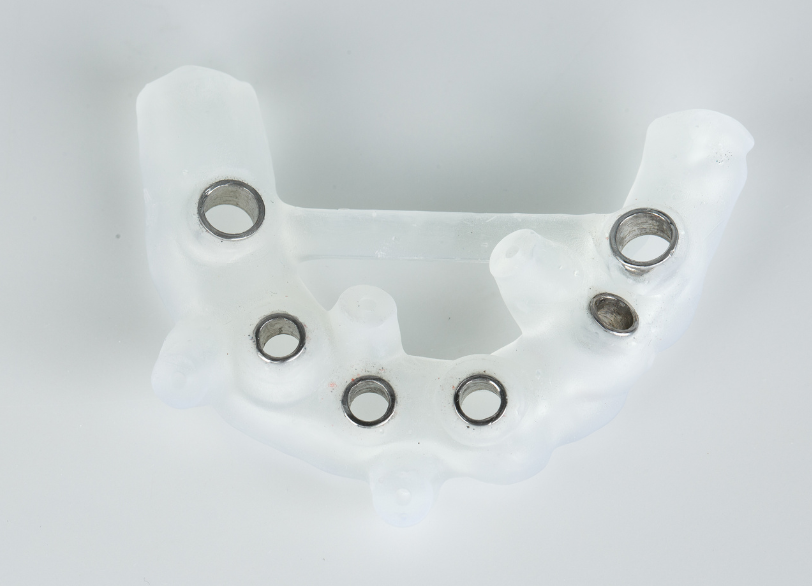 サージカルガイド|しろきデンタル