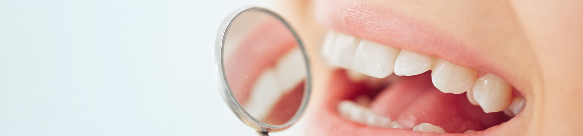 治療から予防へ|しろきデンタル