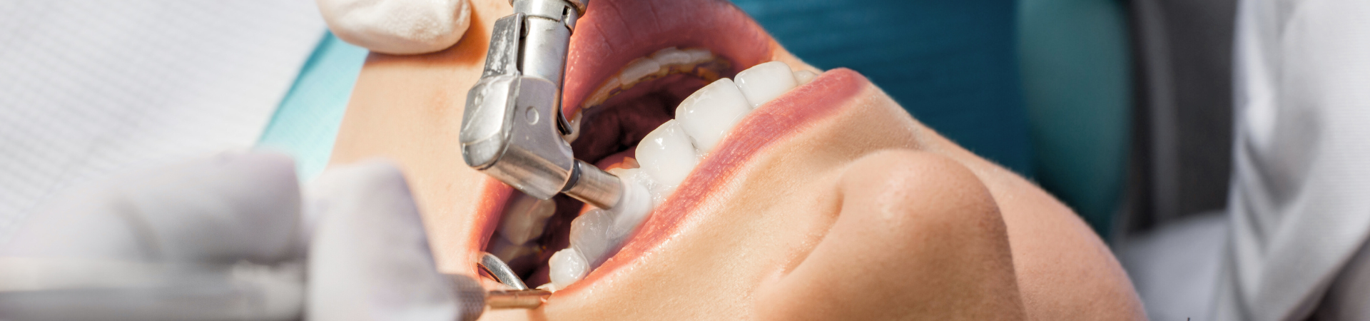 PMTC|しろきデンタル