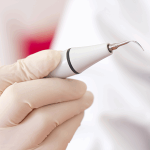 超音波スケーラー｜しろきデンタル