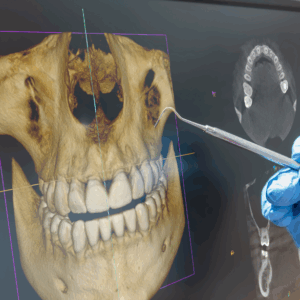 CT｜しろきデンタル