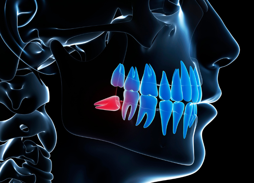 難症例にも対応|しろきデンタル
