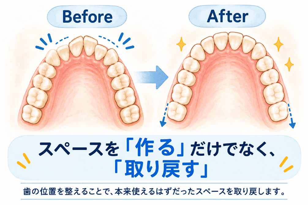 ポステリアディスクレパンシーのイメージ